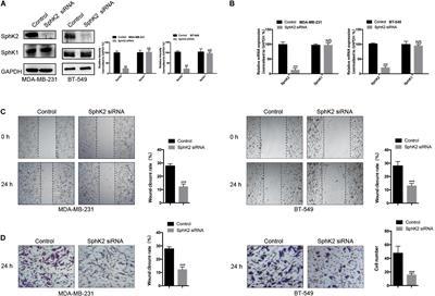 SphK2/S1P Promotes Metastasis of Triple-Negative Breast Cancer Through the PAK1/LIMK1/Cofilin1 Signaling Pathway